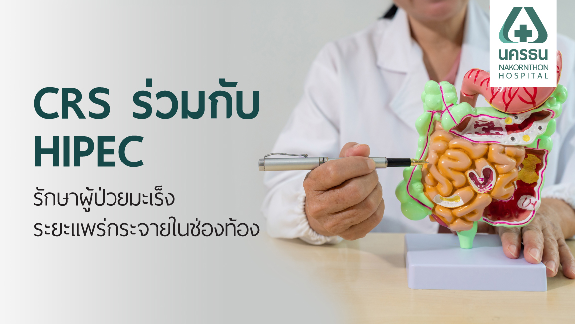CRS และ HIPEC
